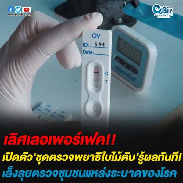 เปิดตัว‘ชุดตรวจพยาธิใบไม้ตับ’รู้ผลทันที!