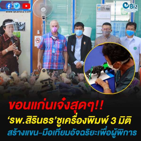 ‘รพ.สิรินธร’ชูเครื่องพิมพ์ 3 มิติสร้างแขน-มือเทียมอัจฉริยะเพื่อผู้พิการ