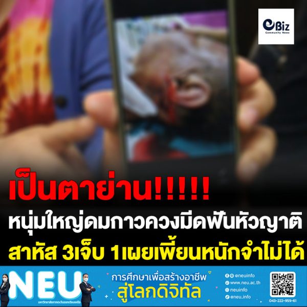 หนุ่มใหญ่ดมกาวควงมีดฟันหัวญาติสาหัส3เจ็บ1เผยเพี้ยนหนักจำแม่ไม่ได้เกือบถูกฆ่าตาย