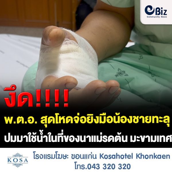 ขอนแก่น พ.ต.อ. โหดจ่อยิงมือน้องชายทะลุ ปมมาใช้น้ำแม่รดต้น มะขามเทศ