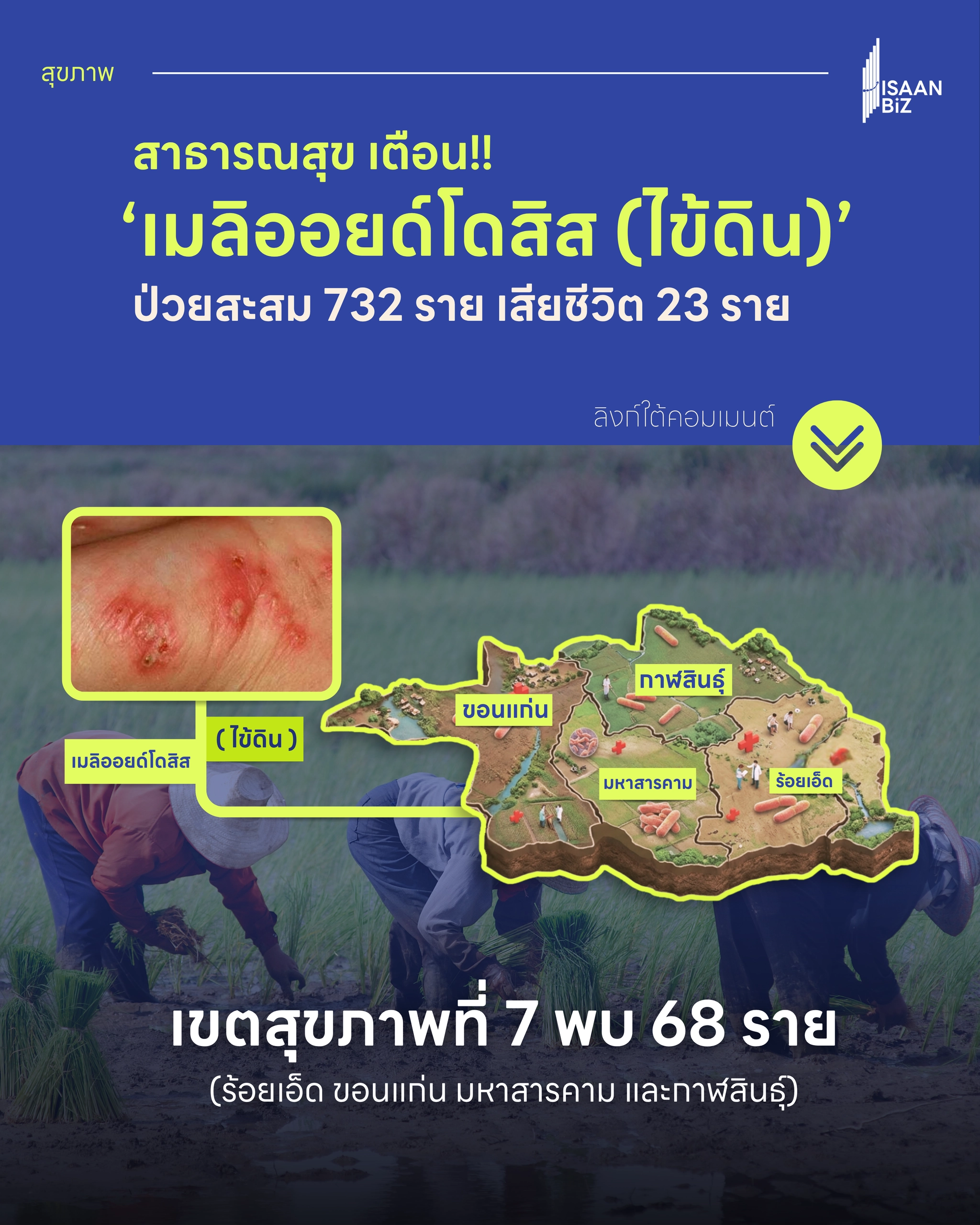 เตือนภัย ‘เมลิออยด์โดสิส’ หรือโรคไข้ดิน ป่วยสะสม 732 ราย เสียชีวิต 23 ราย